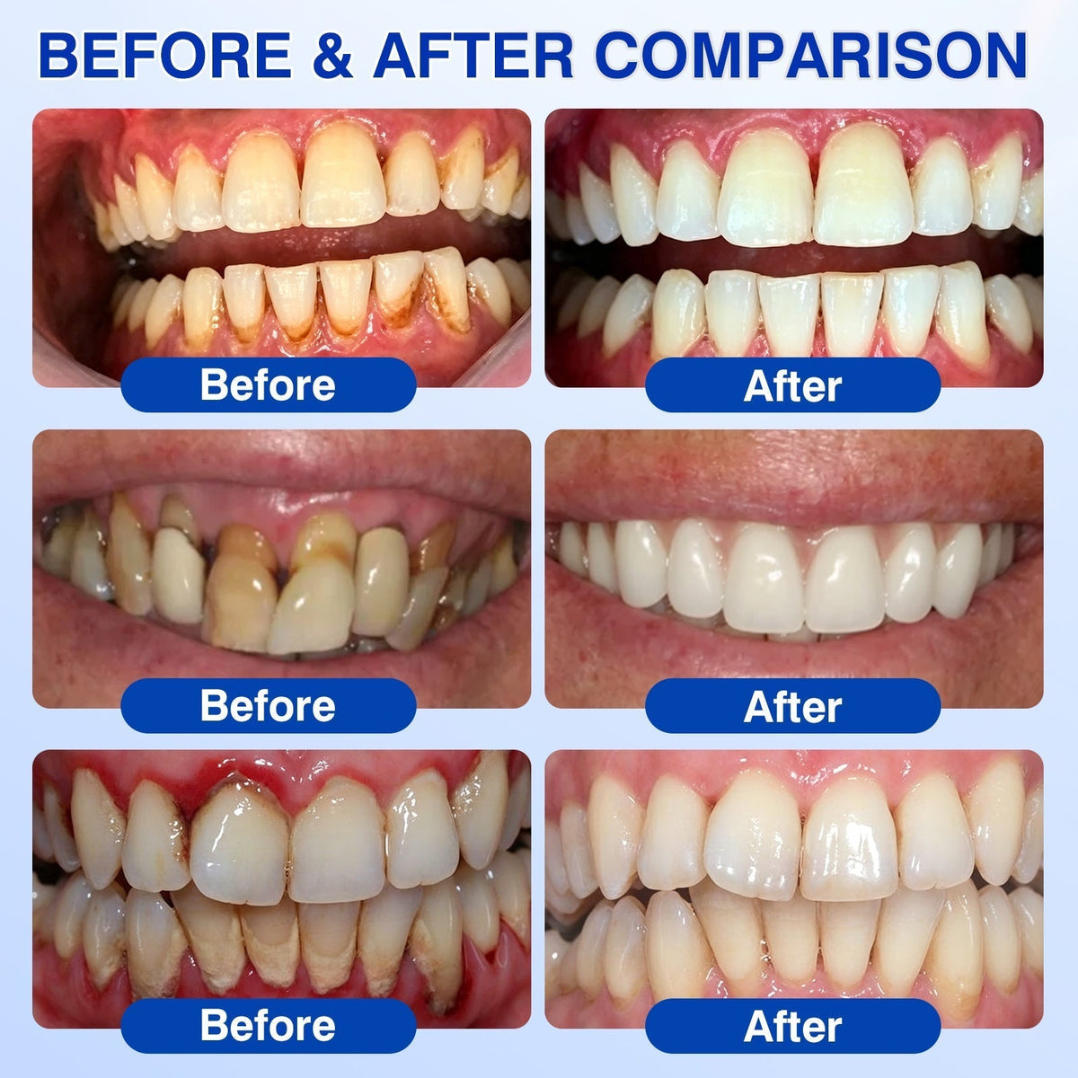 𝐇𝐈𝐒𝐊𝐈𝐍®👩‍⚕️🇨🇦🏅🦷🛡️ HISKIN® GumRevive Periodontal Repair Gel