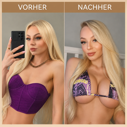 👩‍⚕️ Breast Firming & Fuller-Looking Curves HISKIN® — Advanced Nano-Microneedle Patch for Targeted Care