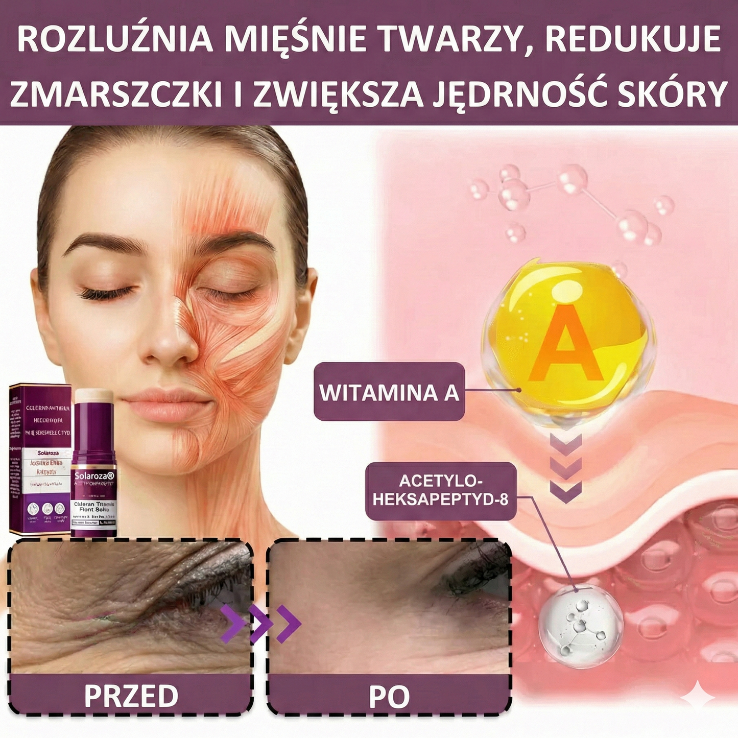 Bestsellerowy krem Solaroza @ Calcium Polycollagen Improvement Cream – zawiera jony wapnia, heksapeptyd-8 oraz ekstrakty z kolagenu roślinnego, które działają na zmarszczki, zapewniając szybką poprawę i 100% efekt przeciwstarzeniowy.