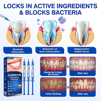 𝐇𝐈𝐒𝐊𝐈𝐍®👩‍⚕️🇨🇦🏅🦷🛡️ HISKIN® GumRevive Periodontal Repair Gel